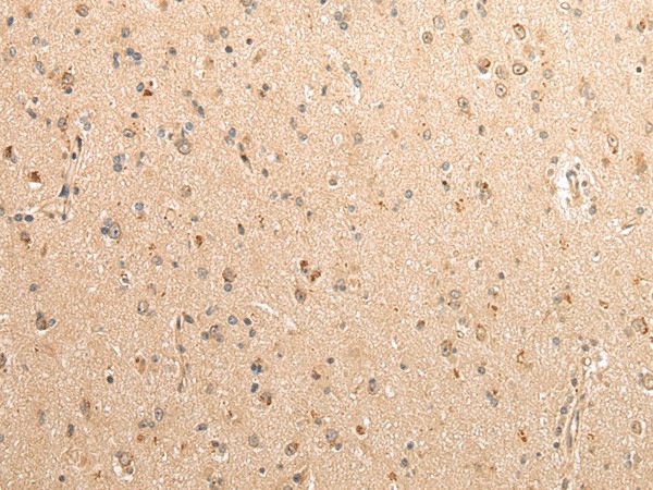 Валидация Elabscience E-AB-17210