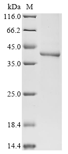 SDS-PAGE