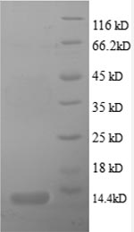 SDS-PAGE