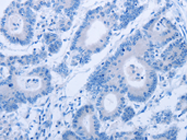 Валидация AssayVector ARM1684(1915)