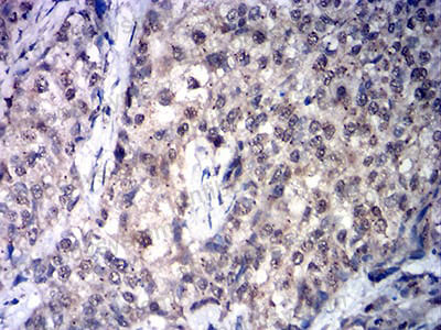 Валидация AntibodySystem RHD48502