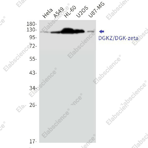 Вестерн-блоттинг, DGKZ/DGK-zeta, клетки HeLa, A549, HL-60, U2OS, U87-MG