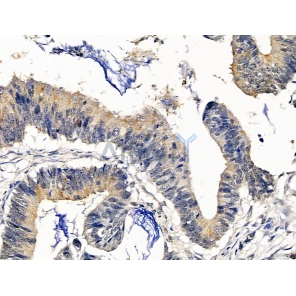 Валидация Affinity DF13561 - 9010