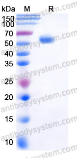 AHJ69202, SDS-PAGE