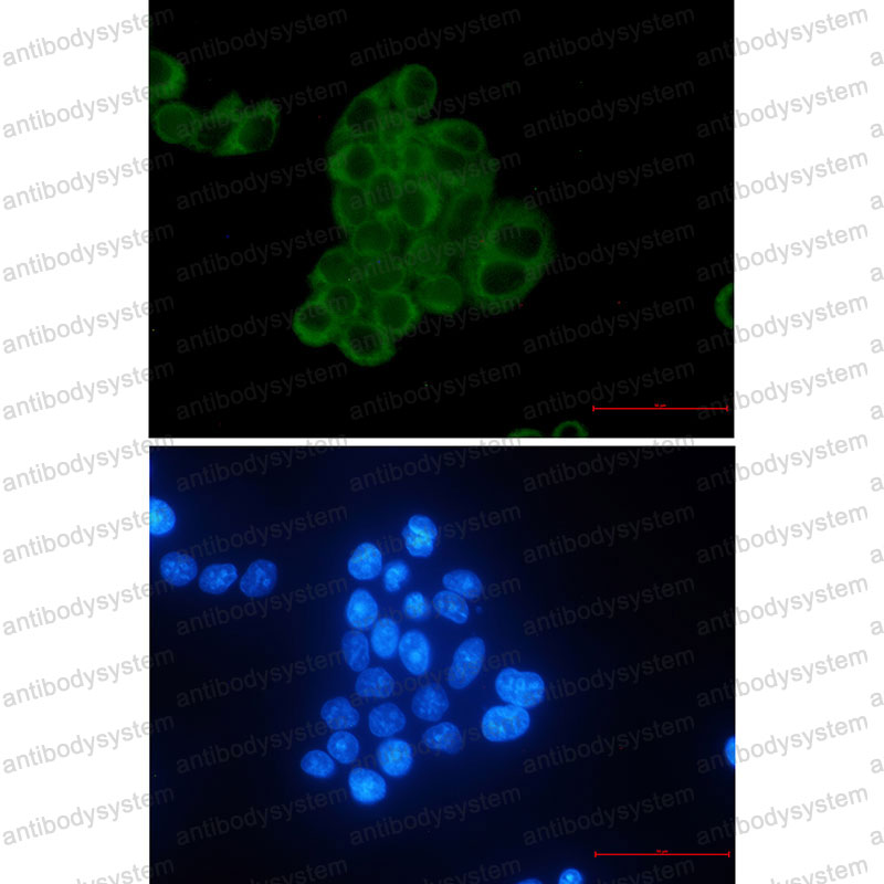 Валидация IF - AntibodySystem RHE17801