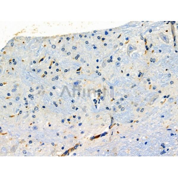 Валидация Affinity DF6144 - 17377