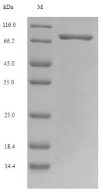 SDS-PAGE