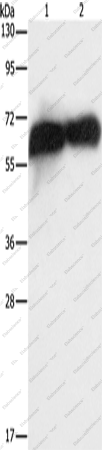 Вестерн-блоттинг, Placental Alkaline Phosphatase, клетки HepG2 и ткань плаценты человека