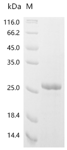 SDS-PAGE