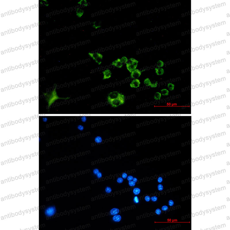 Валидация IF - AntibodySystem RMC27901