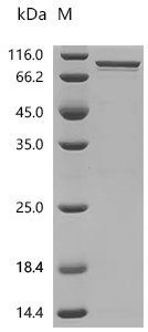 SDS-PAGE