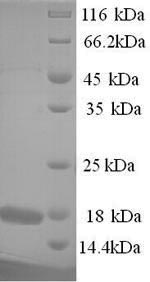 SDS-PAGE