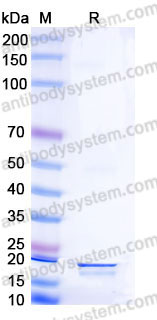 EHB81901, SDS-PAGE