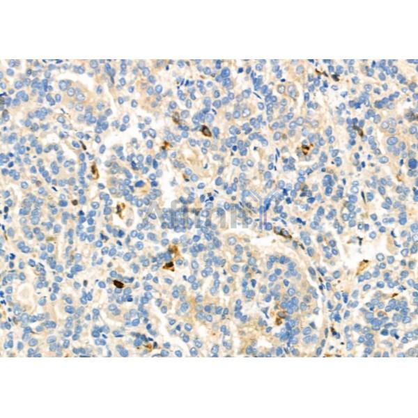 Валидация Affinity DF6896 - 18491