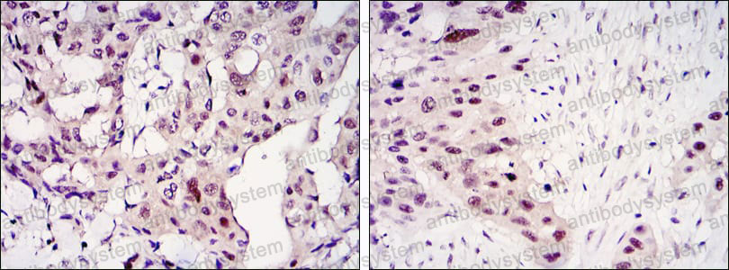 Валидация AntibodySystem RHE27705
