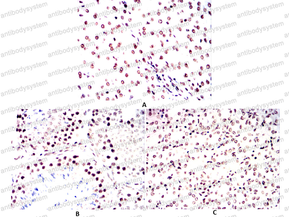 Валидация AntibodySystem RHE37705