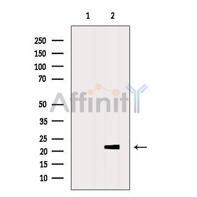 Валидация Affinity DF6700 - 18206