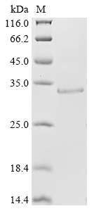 SDS-PAGE