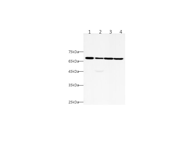 Вестерн-блоттинг, CK5P3, клеточные линии Jurkat, HeLa, A431 и HEK-293T