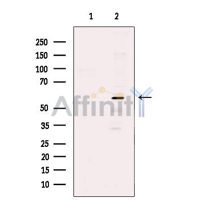 Валидация Affinity DF12457 - 6997