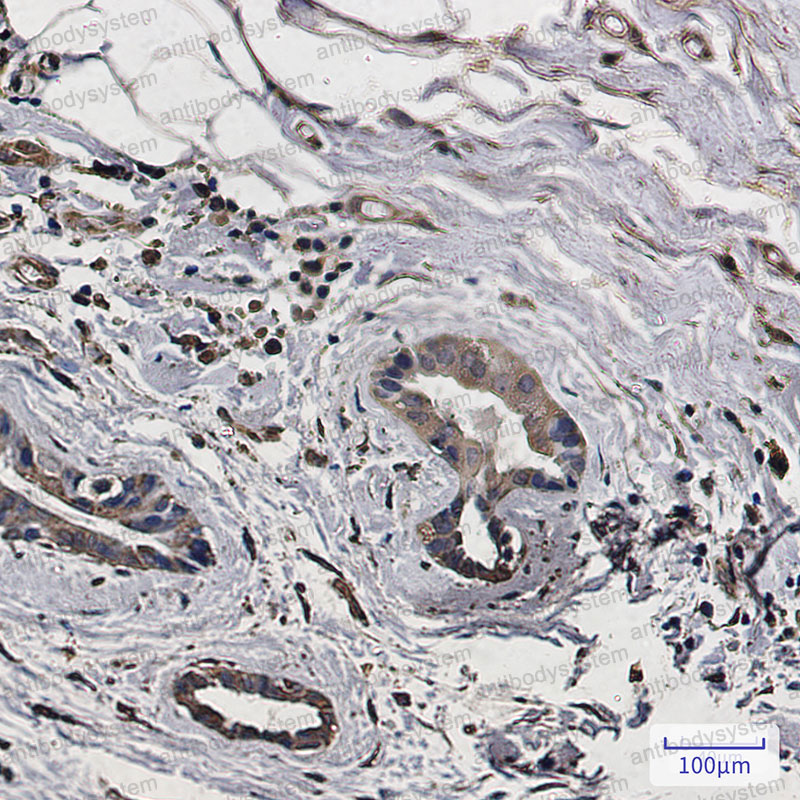 Валидация AntibodySystem RHJ56802