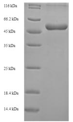 SDS-PAGE