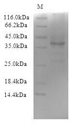 SDS-PAGE