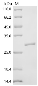 SDS-PAGE