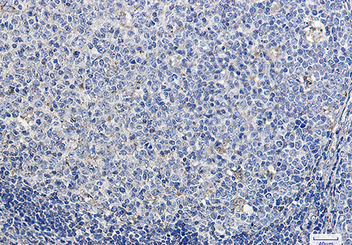 Валидация AntibodySystem RHC87701