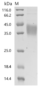 SDS-PAGE