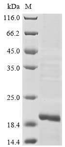 SDS-PAGE