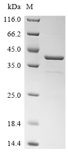 SDS-PAGE