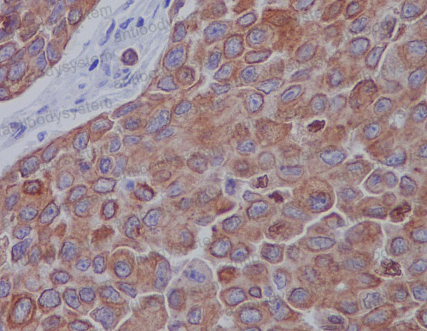 Валидация AntibodySystem RHB53703