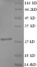 SDS-PAGE