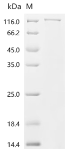 SDS-PAGE