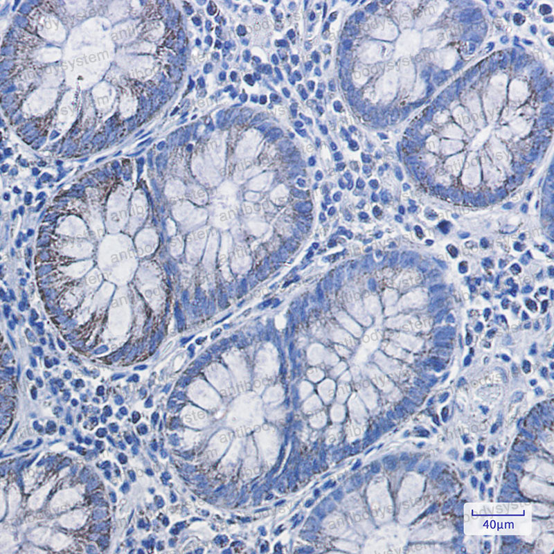 Валидация AntibodySystem RHE28601