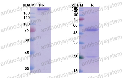 Валидация SDS-PAGE - AntibodySystem DVV00305