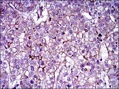 Валидация AntibodySystem RHH49003 (3301)