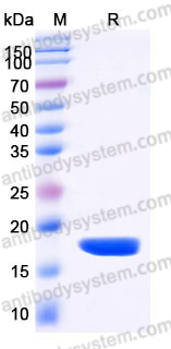 YHJ84202, SDS-PAGE