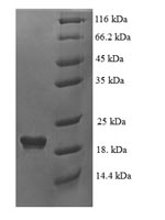 SDS-PAGE