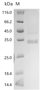 SDS-PAGE
