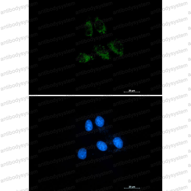 Валидация IF - AntibodySystem RHC23801