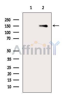 Валидация Affinity AF6620 - 3914