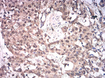 Валидация AntibodySystem RHK65804 (3714)