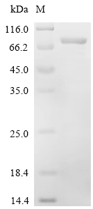 SDS-PAGE