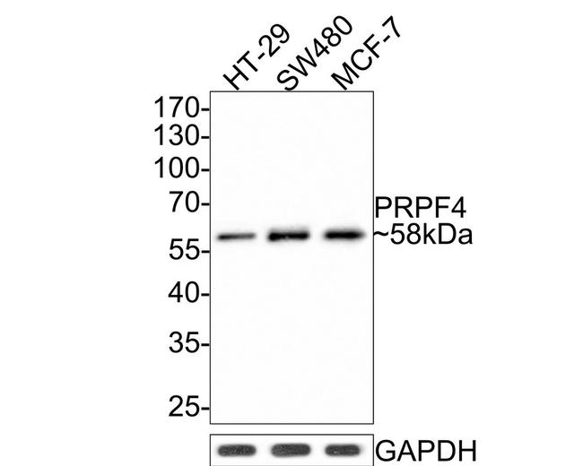Валидация AssayVector ARM2018(3001)