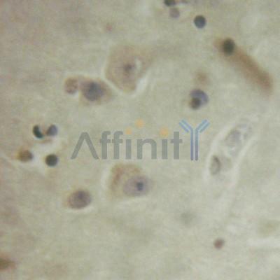 Валидация Affinity AF3466 - 1982