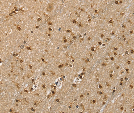 Иммуногистохимия, RNH1, ткань мозга человека