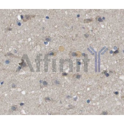 Валидация Affinity AF5148 - 2546