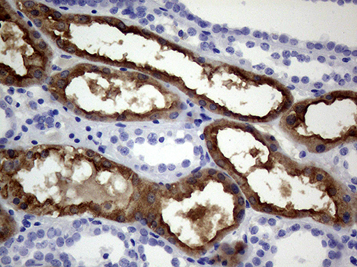 Валидация AssayVector ARM1158(439)